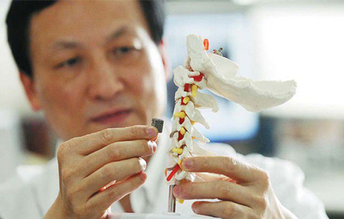 Impressora 3D fabrica primeira prótese de vértebra na China