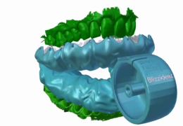 Blizzident: a escola de dente feita em impressora 3D